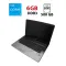 Ноутбук Acer Medion E7222 / 17.3" (1600x900) TN / Intel Core i5-2540M (2 (4) ядра по 2.6 - 3.3 GHz) / 6 GB DDR3 / 500 GB HDD / Intel HD Graphics 3000 / WebCam б/в